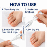 Foot nail fungus pen 4ml nail repair undecylenic acid treatment for toenails